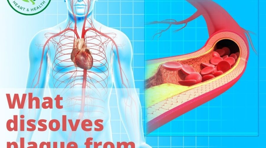 Cholesterol and Cardiovascular Health Tips and Tricks