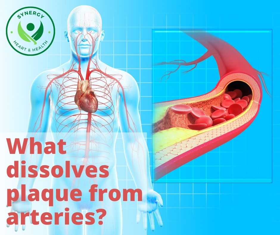 What Dissolves Plaque From Arteries 