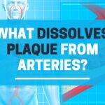 What dissolves plaque from arteries naturally?