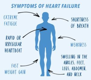 What I'd co q 10 for heart failure