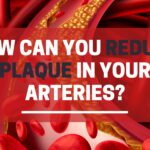 How can you reduce plaque in your arteries?