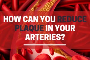 How can you reduce plaque in your arteries?