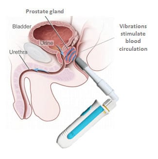 Prostate massager for enlarged prostate