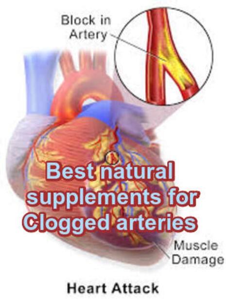 Best natural supplements for clogged arteries image