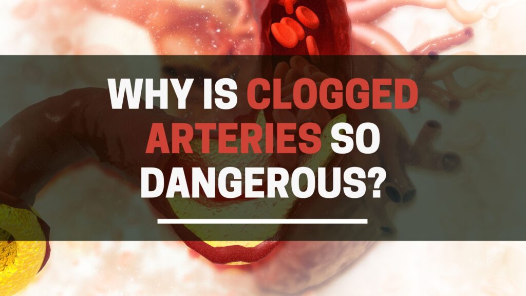 Why is Clogged Arteries so Dangerous?